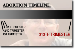 Pictured: a helpful abortion timeline.